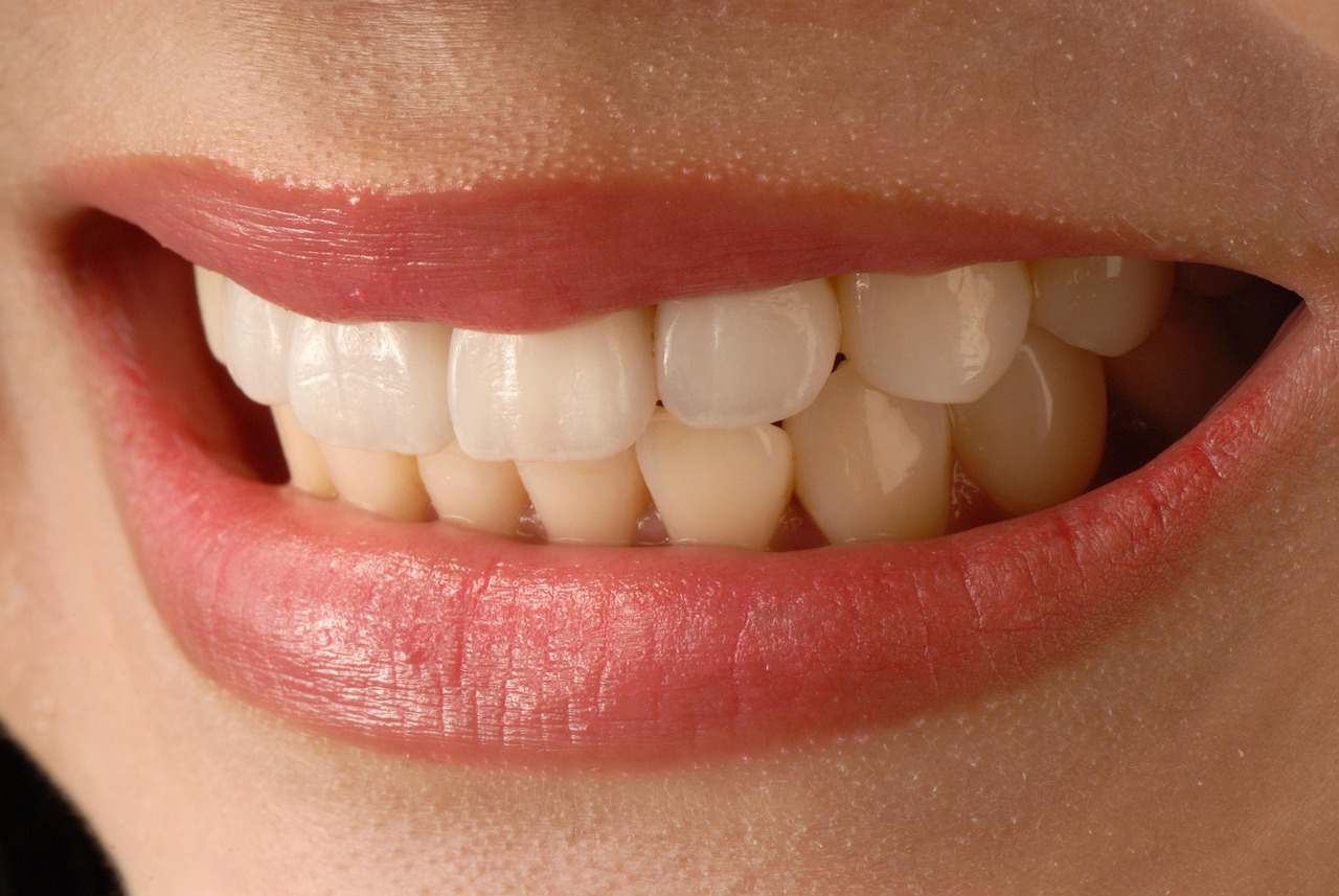 Smile Designing